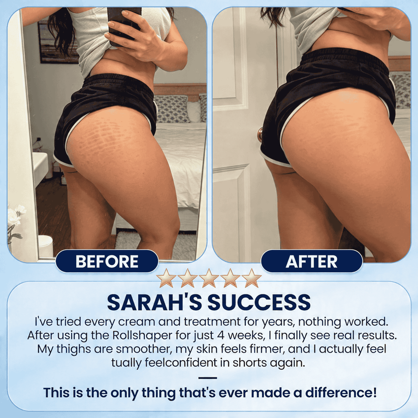 Rollshaper | Smoother, firmer skin